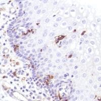 Anti-CD14 antibody [SP192](AB183322)