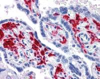 Rig I Ddx58 Antibody Ab111037  Immunohistochemistry Formalin Pfa Fixed Paraffin Embedded Sections Img42421