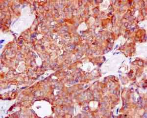 Kbtbd11 Antibody Epr100562b Bsa And Azide Free Ab249501  Immunohistochemistry Formalin Pfa Fixed Paraffin Embedded Sections Img118897
