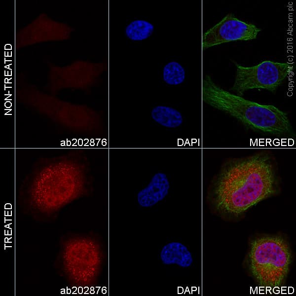 Alexa Fluor 555 Stat3 Phospho Y705 Antibody Ep2147y Ab202876  Immunocytochemistry Immunofluorescence Img29232