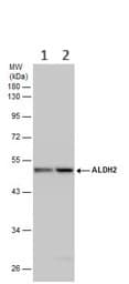 Anti-ALDH2 antibody(AB227021)