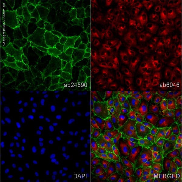 Anti-CD31 antibody [P2B1](AB24590)
