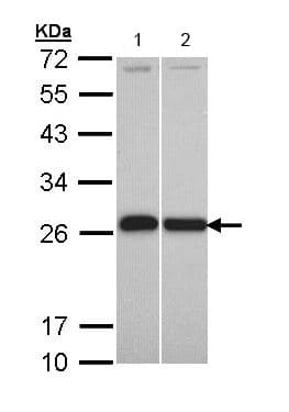 Anti-GST3 / GST pi antibody(AB153949)