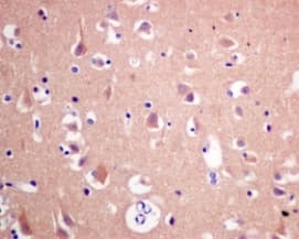 Eef1a1 Ef Tu Eef1a1 Ee1al3 Eef1a1p5 Antibody Epr9470 Ab140632  Immunohistochemistry Formalin Pfa Fixed Paraffin Embedded Sections Img135417