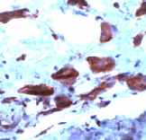 Anti-COX2 / Cyclooxygenase 2 antibody(AB15191)