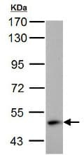 Abat Gaba T Antibody Ab152134  Western Blot Img159122