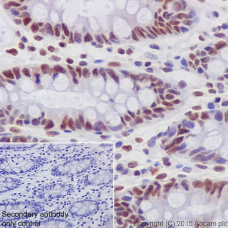 Gatad2a Antibody Epr18252 Ab188472  Immunohistochemistry Formalin Pfa Fixed Paraffin Embedded Sections Img133623