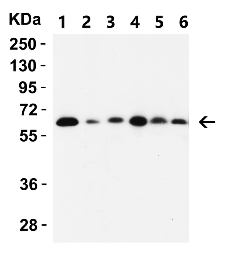 Anti-SQSTM1 / p62 antibody(AB91526)