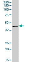 Rad51ap1 Antibody Ab88370  Western Blot Img162182