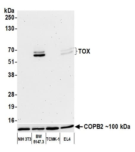 Anti-TOX antibody [BLR212K] - BSA free(AB314043)
