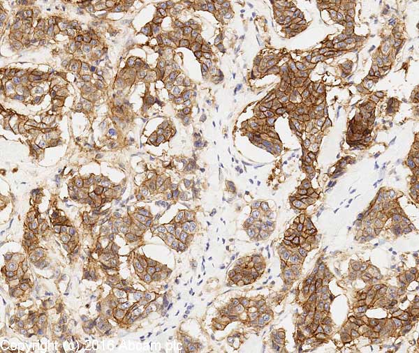 Anti-EpCAM antibody(AB71916)