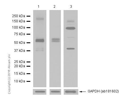 Anti-MMP14 antibody [EP1264Y](AB51074)