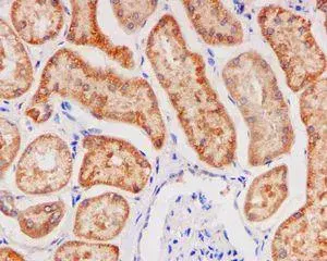 Anti-Glutathione Peroxidase 4 antibody [EPNCIR144](AB125066)