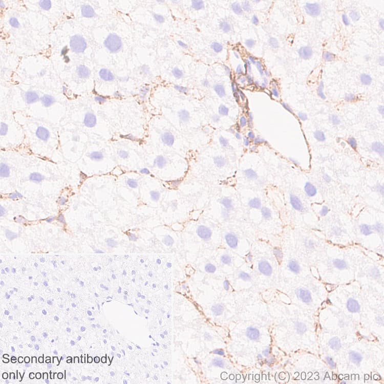 Marcks Antibody Epr28261 90 Bsa And Azide Free Ab315026  Immunohistochemistry Formalin Pfa Fixed Paraffin Embedded Sections Img423777