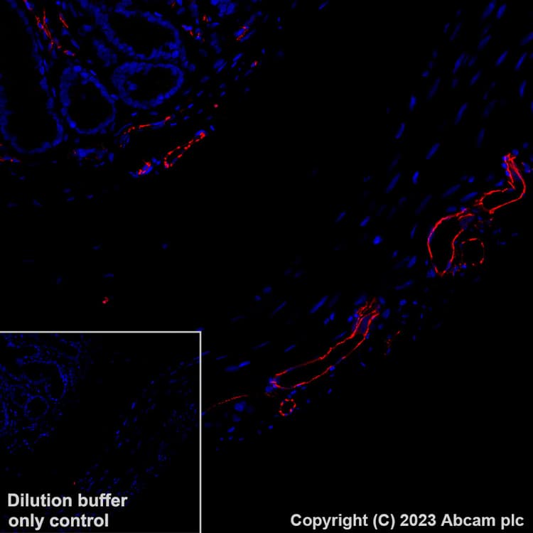 Alexa Fluor® 555 Anti-CD31 antibody [EPR17259](ab312892)