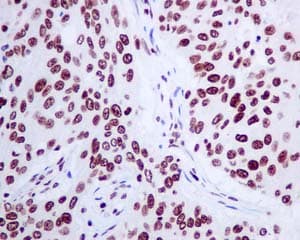 Anti-Histone H2A.Z antibody [EPR6171(2)(B)] - ChIP Grade(AB150402)