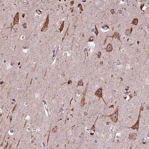 Anti-IPO11 antibody(AB221615)