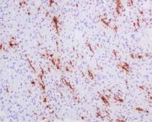 Anti-Myelin Basic Protein antibody [EPR6652](AB133620)