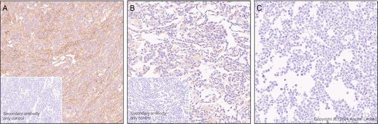 Antigen Retrieval Buffer (100X Citrate Buffer)(AB93678)