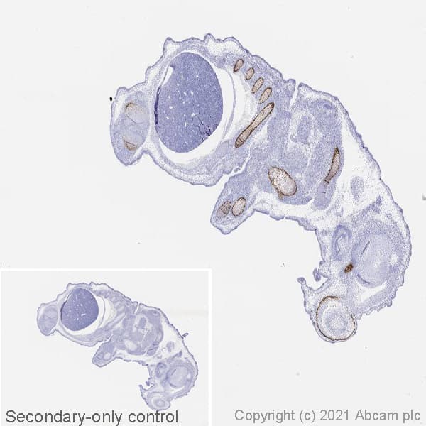 Anti-Sp7 / Osterix antibody [EPR21034](AB209484)