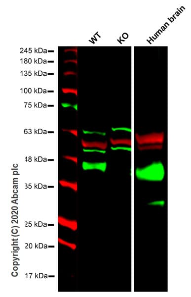 Anti-Synaptophysin antibody [YE269](ab32127)