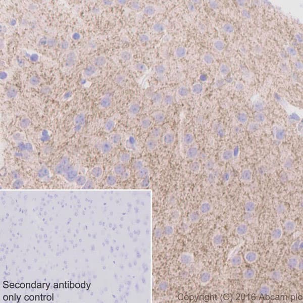 Anti-Tyrosine Hydroxylase antibody [EP1532Y] - Neuronal Marker(AB137869)