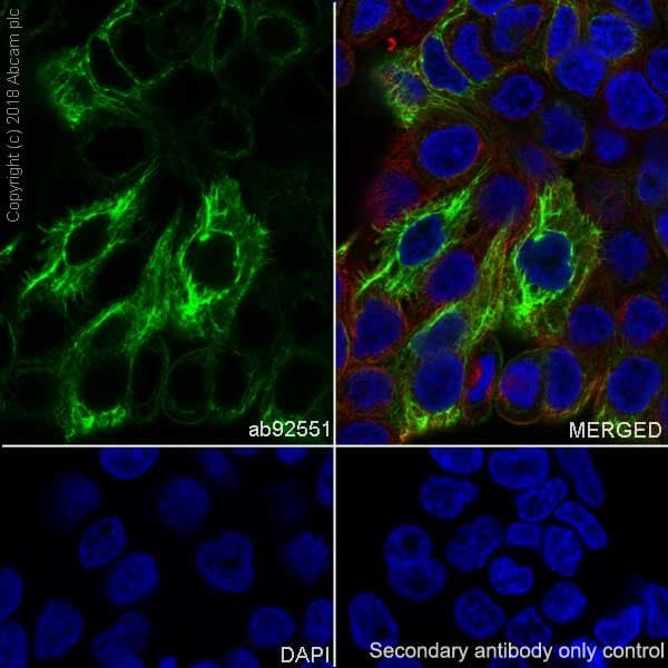 Anti-Cytokeratin 13 antibody [EPR3671](AB92551)