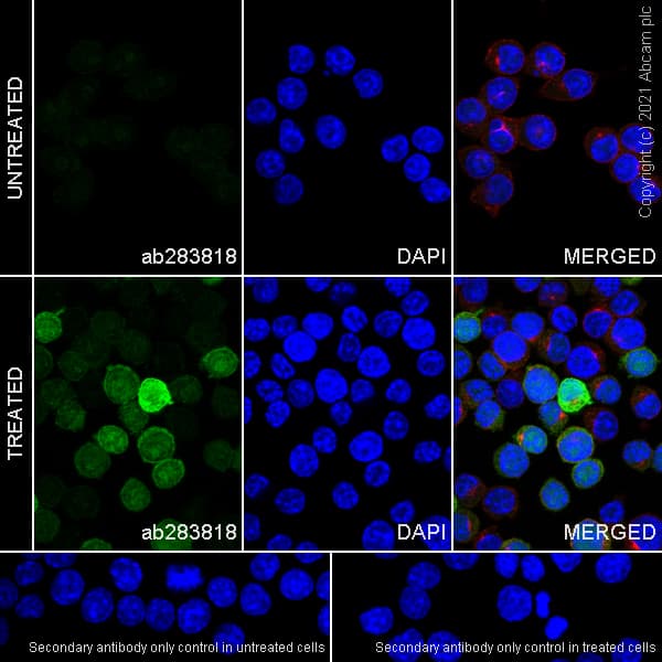 Anti-IL-1 beta antibody [RM1009](AB283818)