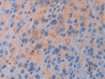 Anti-IL-18R1 antibody(ab231565)