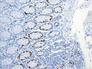 Anti-Ki67 antibody [EPR3610](AB92742)