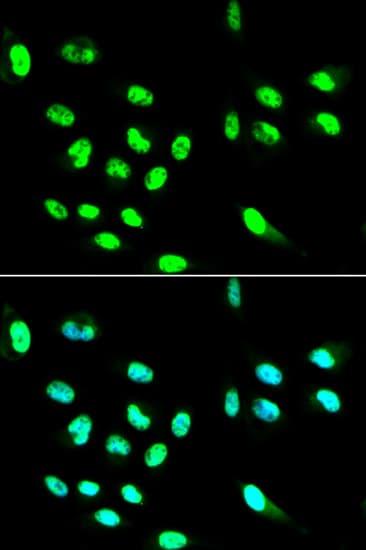 Cd32a Antibody Ab175030  Immunocytochemistry Immunofluorescence Img62342