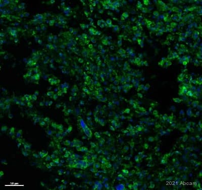 Anti-VEGF Receptor 1 antibody [Y103](AB32152)