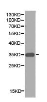 Cd32a Antibody Ab175030  Western Blot Img46320