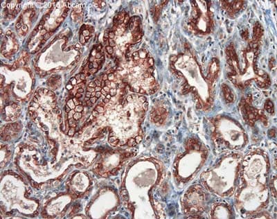 Anti-EpCAM antibody(AB71916)