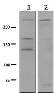Anti-Dystrophin antibody [EPR9598(ABC)](AB154168)