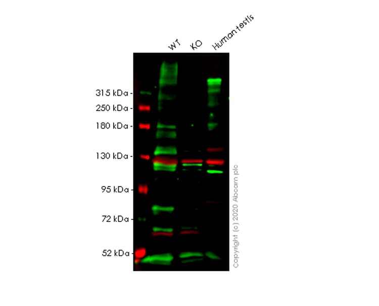 Anti-LAMA1 antibody [CL3087](AB210954)