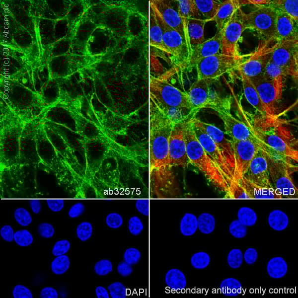 Anti-alpha smooth muscle Actin (acetyl E3) + ACTG2 (acetyl E3) antibody [E184](AB32575)