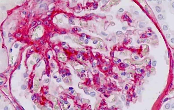 Anti-Collagen IV alpha 1 antibody(AB189408)