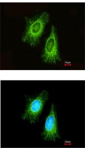 Etfa Antibody Ab153722  Immunocytochemistry Immunofluorescence Img42683