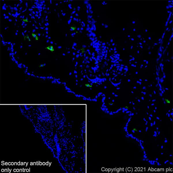 Anti-Langerin antibody [EPR24685-12](AB283686)