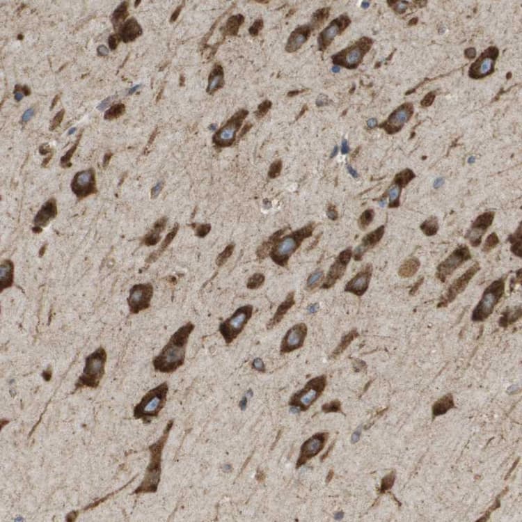 St3gal2 Antibody Ab254726  Immunohistochemistry Formalin Pfa Fixed Paraffin Embedded Sections Img27973