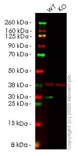 Hmgb2 Antibody Epr6301 Ab124670  Western Blot Img56125
