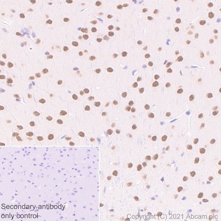 Anti-BAP1 antibody [EPR22826-65](ab255611)