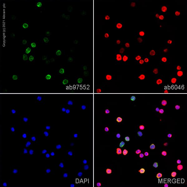 Cd39 Antibody Ac2 Ab97552  Immunocytochemistry Immunofluorescence Img173990