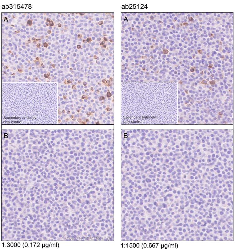 Anti-MCP1 antibody [RM1100](AB315478)