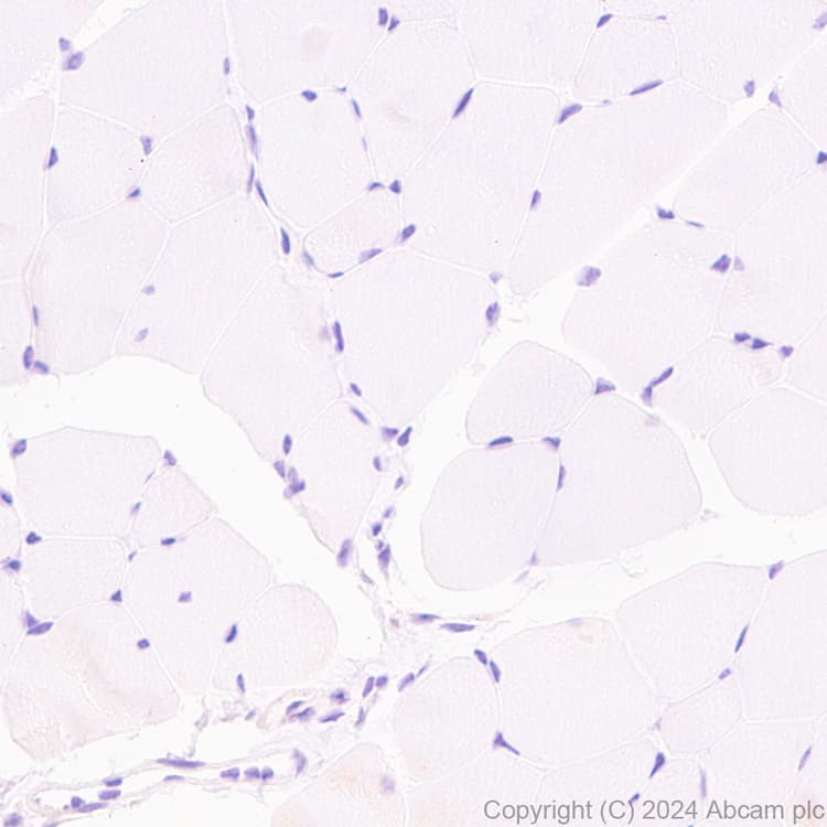 Anti-Slc25a1 antibody [EPR29193-92](AB318201)