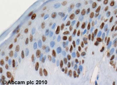Anti-MEF2D antibody(AB32845)
