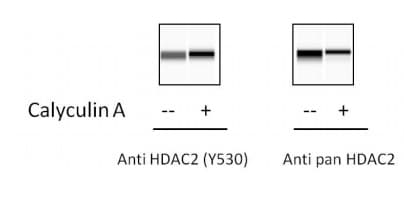 Phospho Hdac2 S394 Elisa Kit Ab279818  Sandwich Elisa Img7302