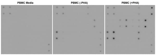 Human Inflammation Antibody Array - Membrane (20 targets)(AB169804)
