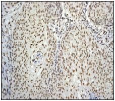 Pabpn1 Antibody Ep3000y Bsa And Azide Free Ab232513  Immunohistochemistry Formalin Pfa Fixed Paraffin Embedded Sections Img125686